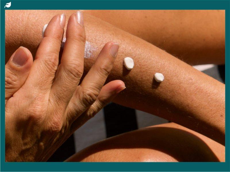 Hand rubbing sunscreen dots into sun-tanned skin outdoors